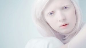 Nastya Kumarova  albino model