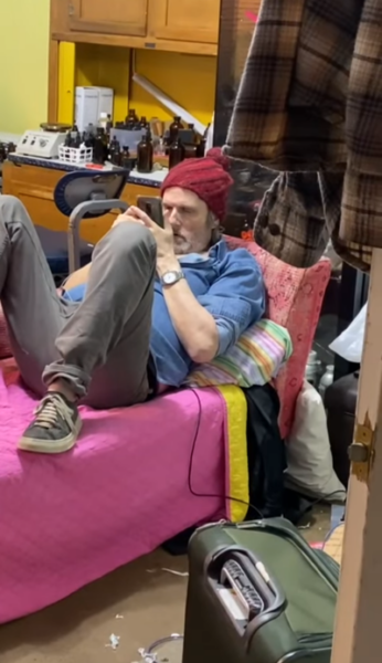 David Falsberg had Stephens- Johnson Syndrome